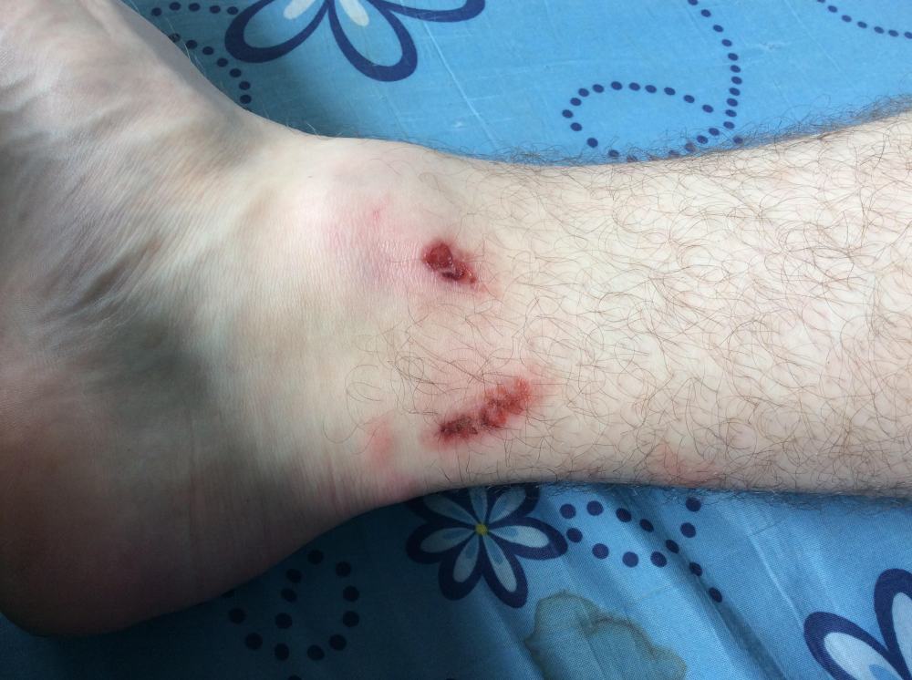 leg.jpg